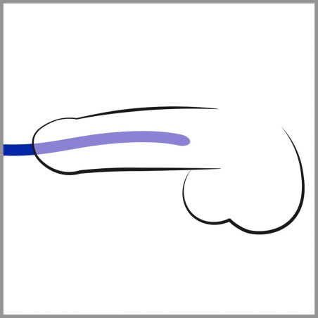 Lot de 3 Tiges d'urètre Silicone 16cm | Diamètre de 7 à 12mm