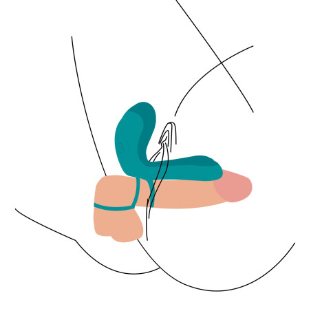 Cockring avec étui vibrant VIBRATOR GREEN 10 x 2.8cm
