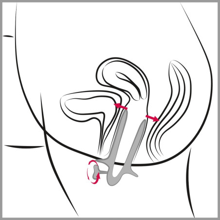 Spéculum anal en métal ASS VIEW 10.5 cm Ouverture 10 cm