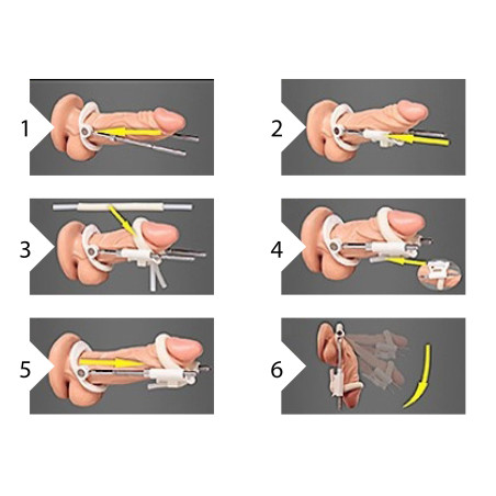 Extenseur de Pénis EXTENDER Blanc