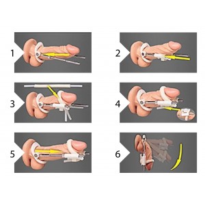 Extenseur de pénis EXTENDER Noir