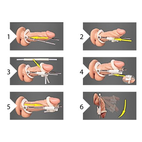 Extenseur de pénis EXTENDER Noir